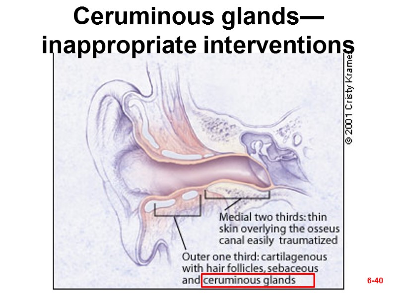 6-40 Ceruminous glands—inappropriate interventions